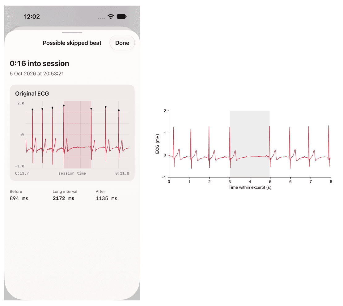 L'application SYMPATHETIC transforme un Polar H10 en coach de respiration